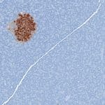 islets of Langerhans pancreas diabetes