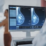 breast cancer